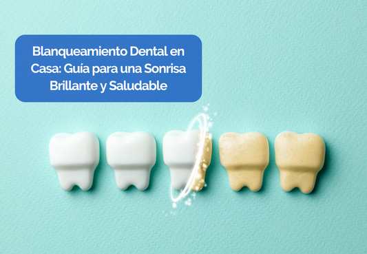 Blanqueamiento dental en casa: Guía para una sonrisa brillante y saludable
