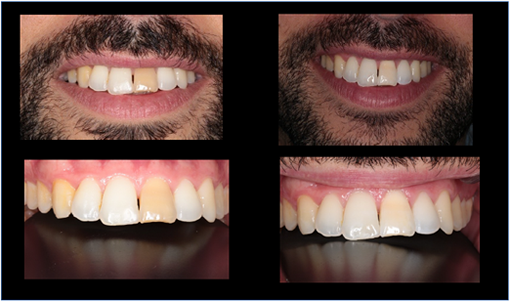 ¿Vale la pena hacerse un tratamiento en un dentista?