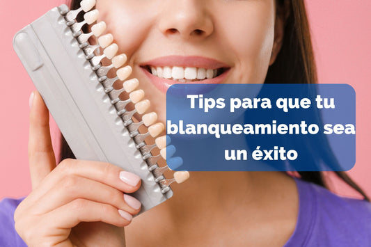 Tips para que tu blanqueamiento sea un éxito