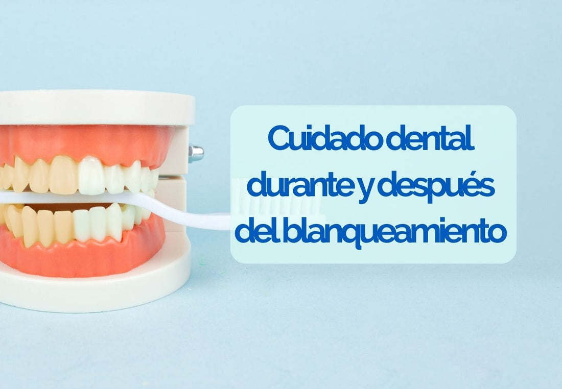 Cuidado dental durante y después del blanqueamiento: Lo que debes saber